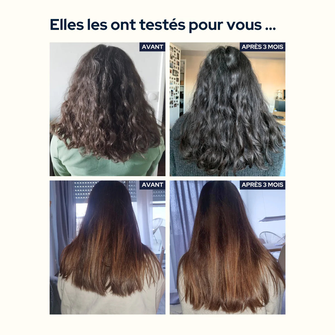 Hair & Nail Gummies - 1 month by Epycure before and after